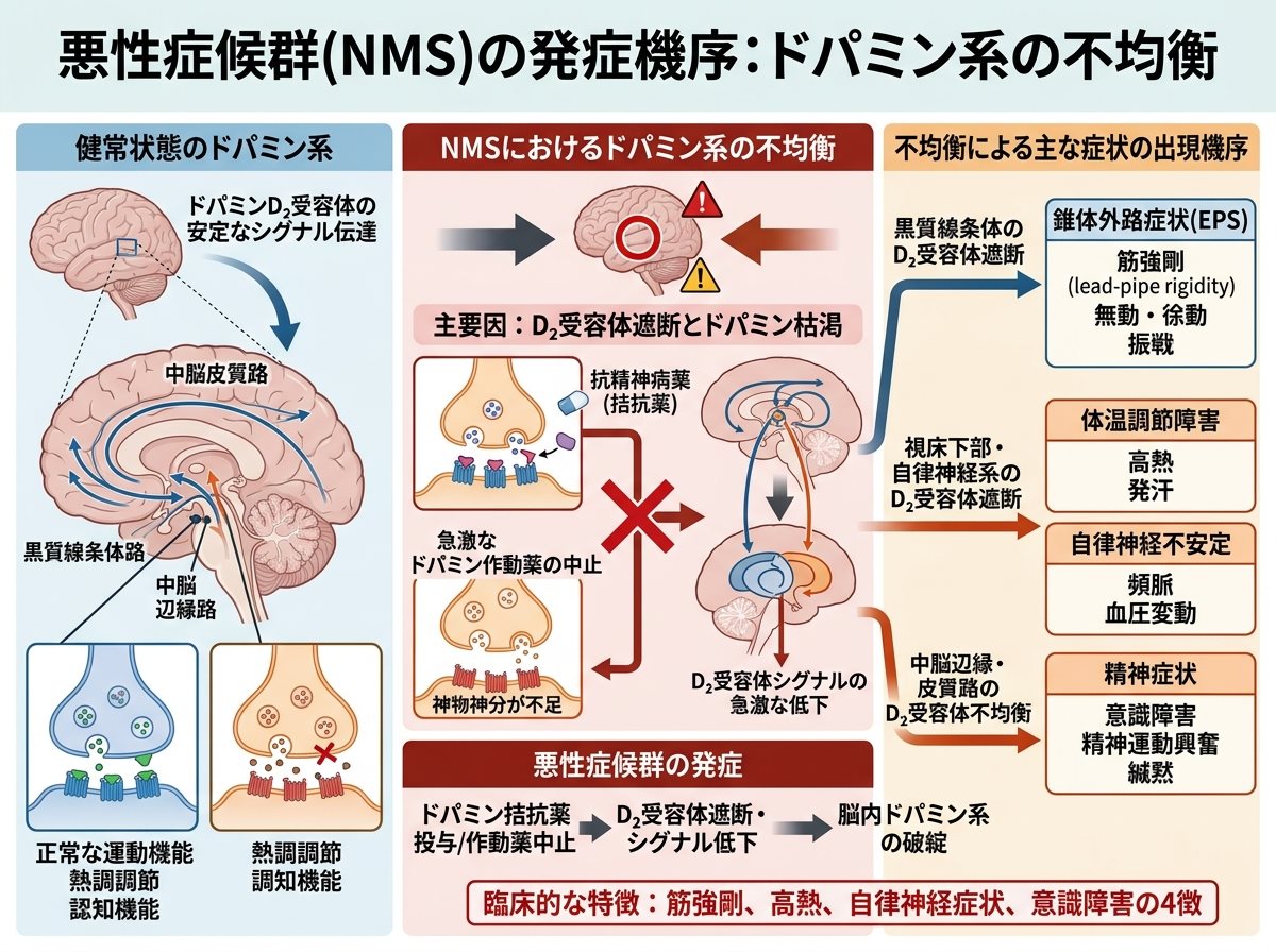悪性症候群の発症機序:ドパミン系の不均衡
