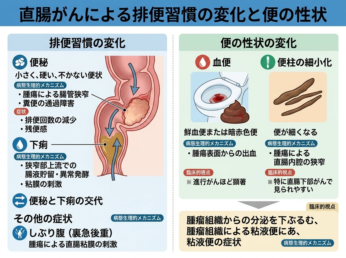 直腸がんによる排便習慣の変化と便の性状