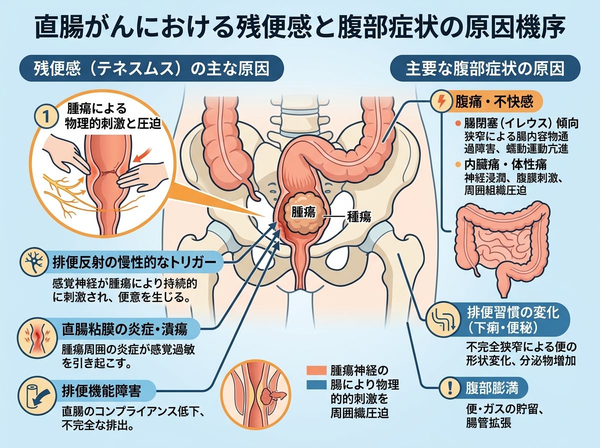 直腸がんの残便感と腹部症状の原因