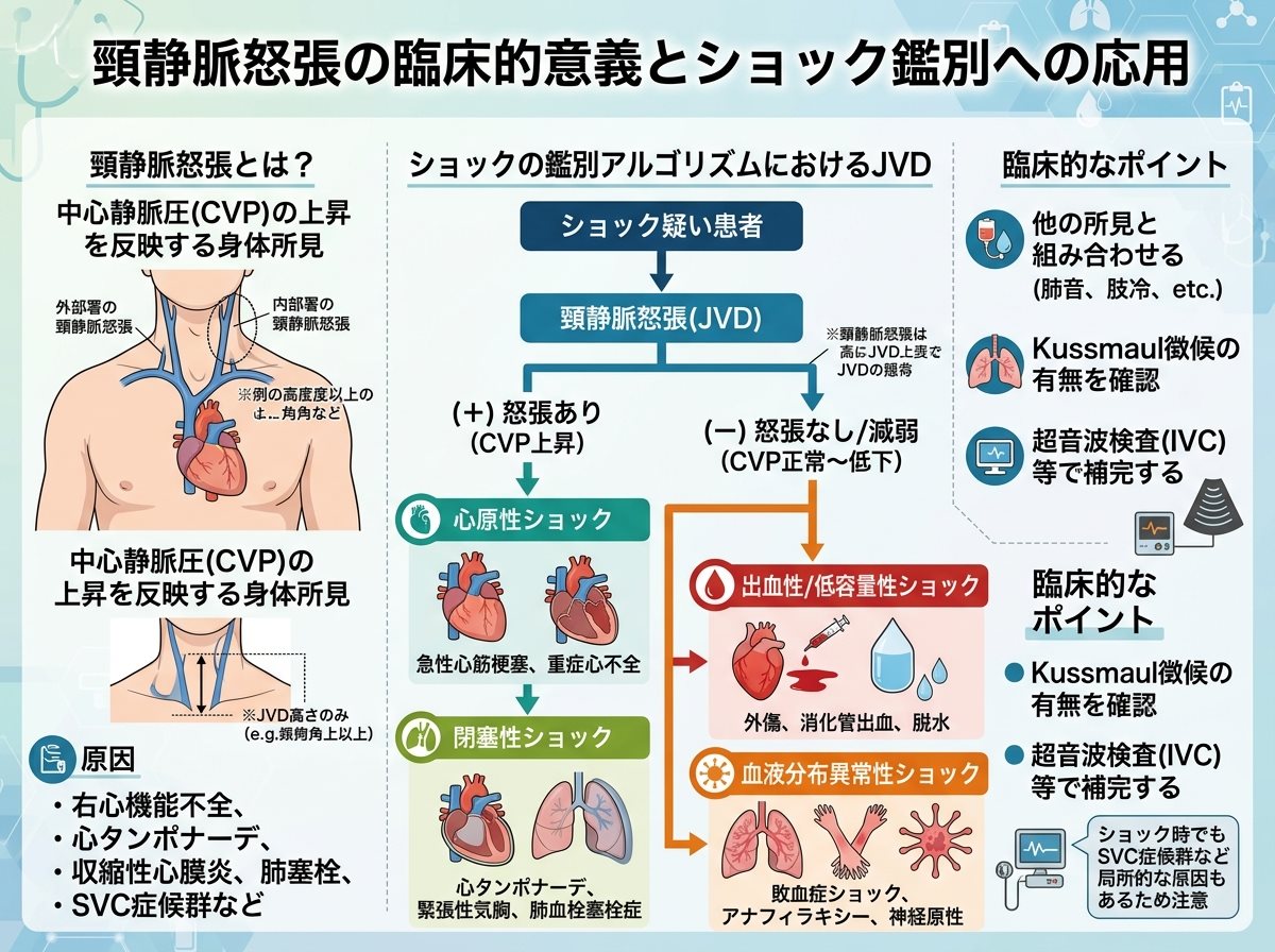 頸静脈怒張の臨床的意義とショック鑑別への応用