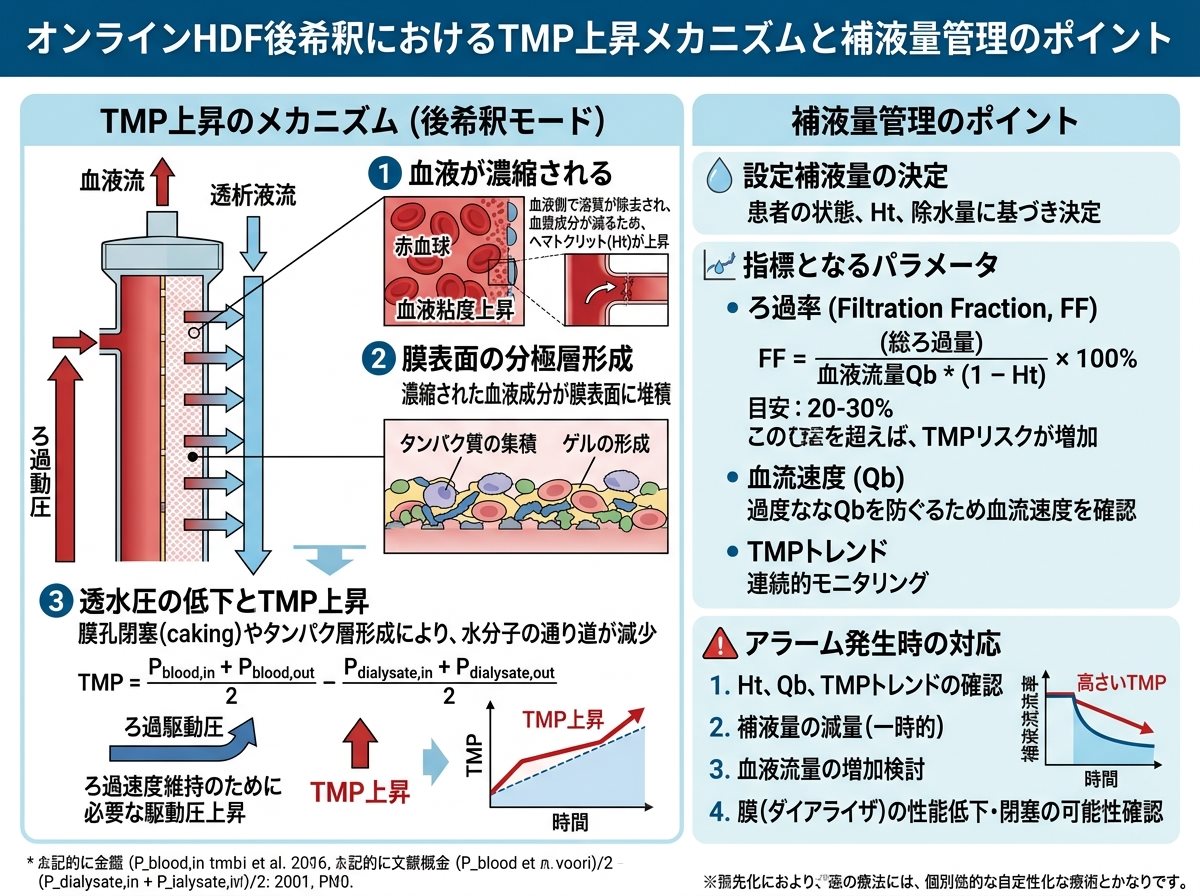 オンラインHDF後希釈でTMPが上昇するメカニズムと補液量管理のポイント