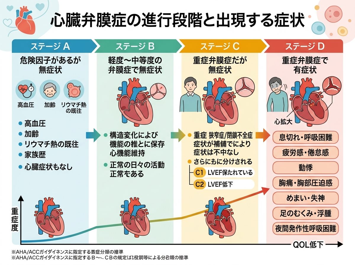 心臓弁膜症の進行段階と出現する症状