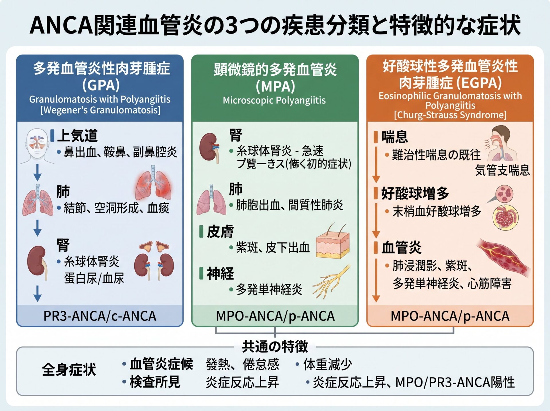 ANCA関連血管炎の3つの疾患分類と特徴的な症状