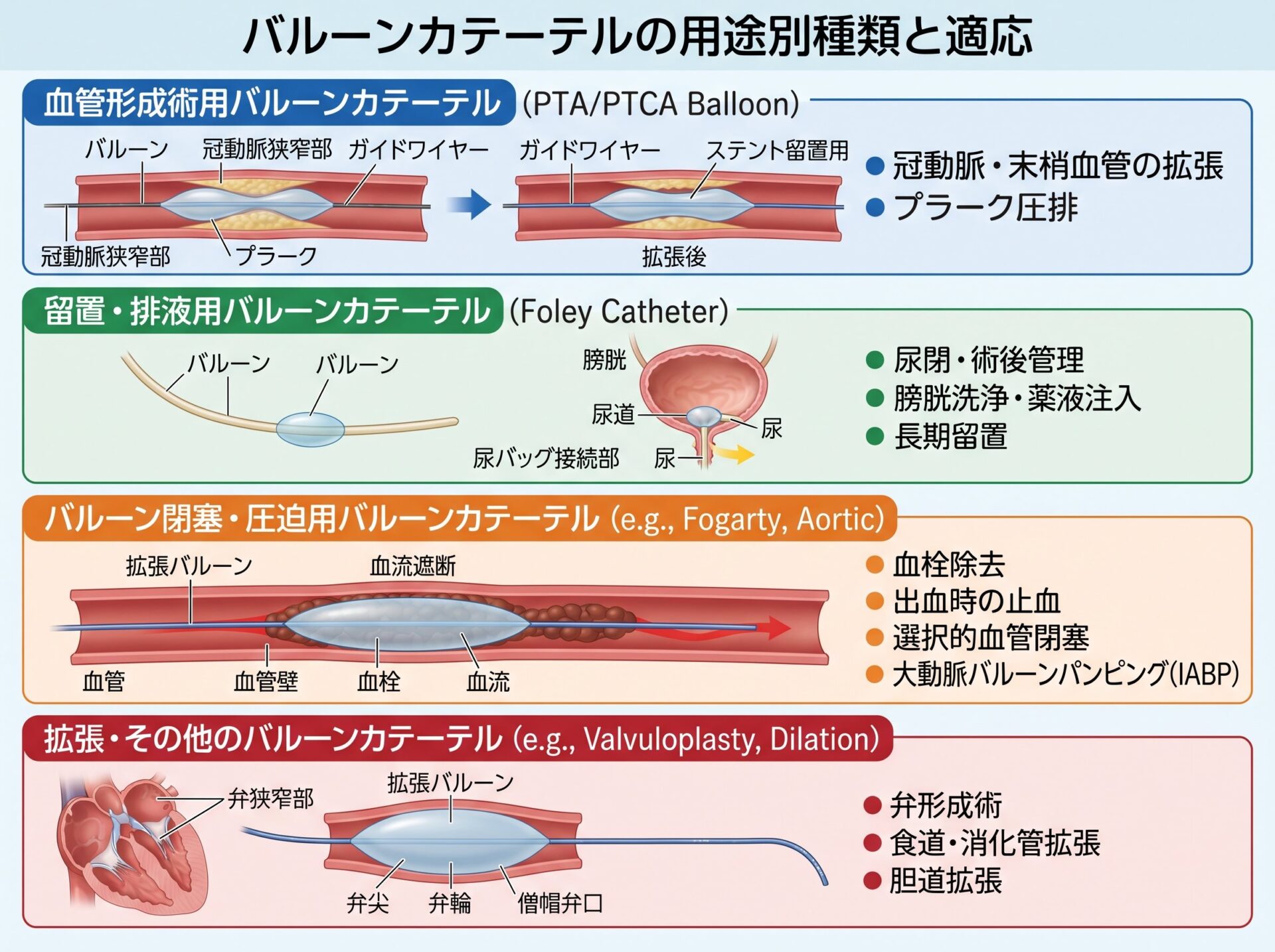 バルーンカテーテルの用途別種類と適応