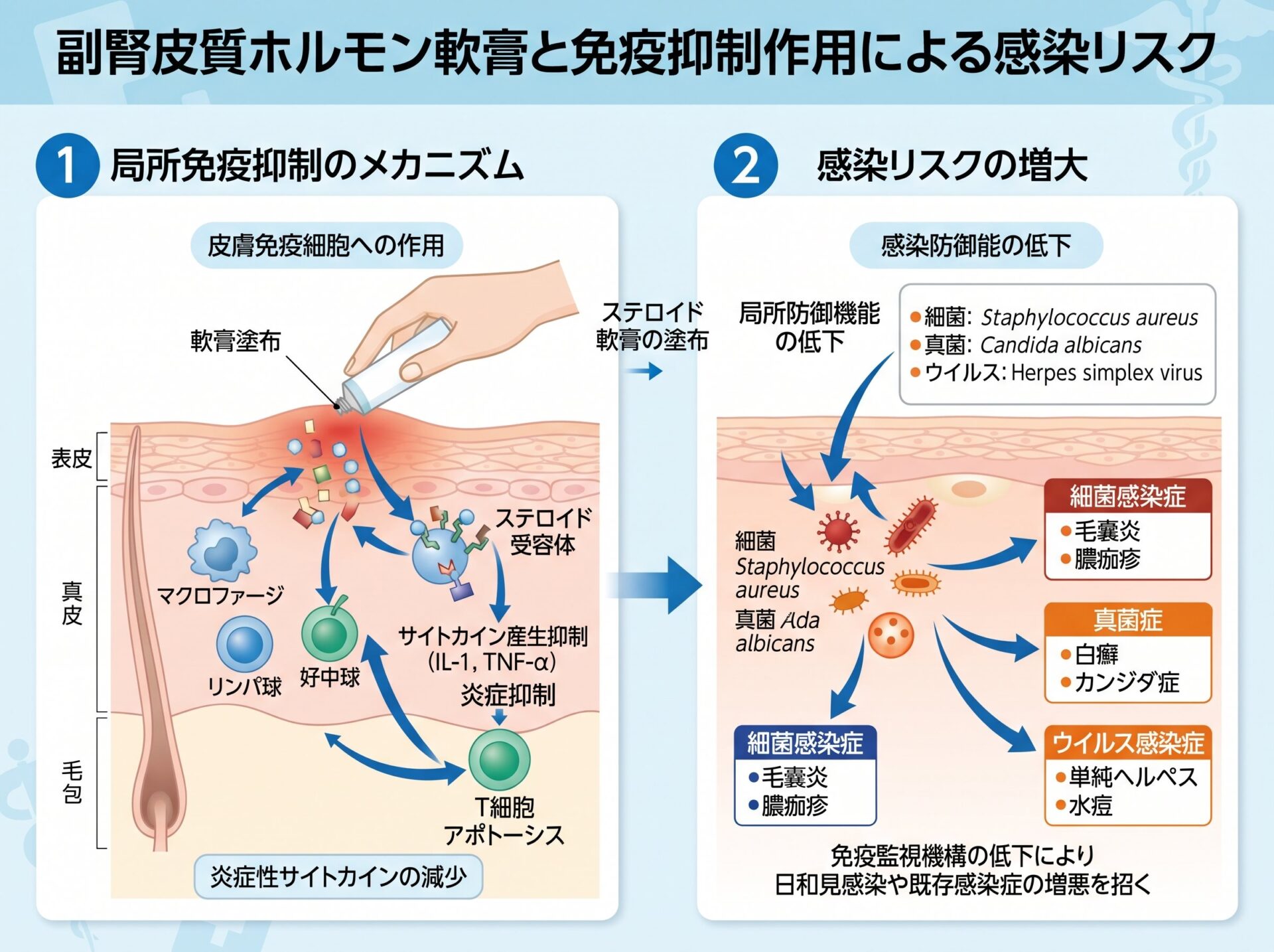 副腎皮質ホルモン軟膏と免疫抑制作用による感染リスク
