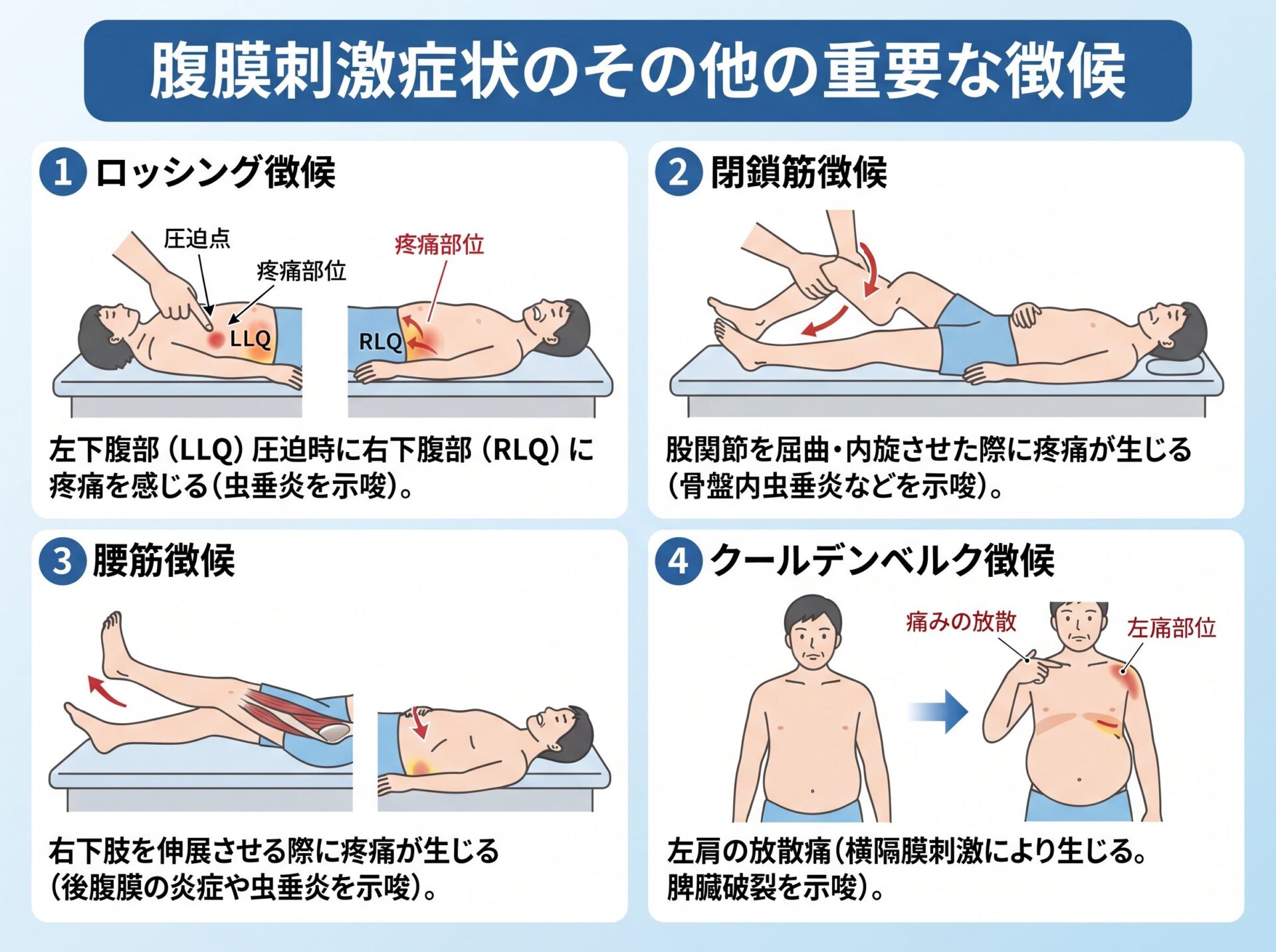 腹膜刺激症状のその他の重要な徴候
