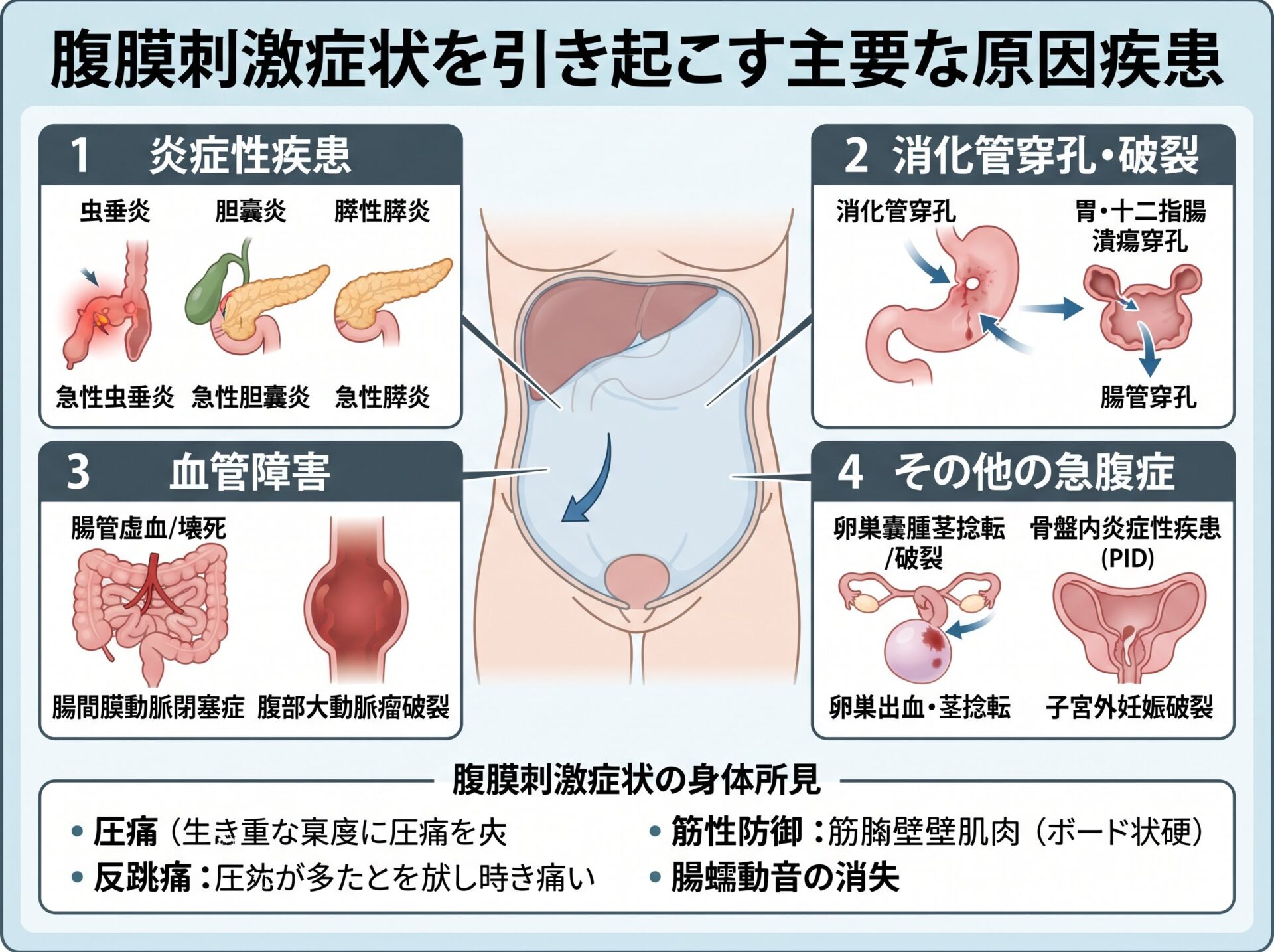 腹膜刺激症状を引き起こす原因疾患