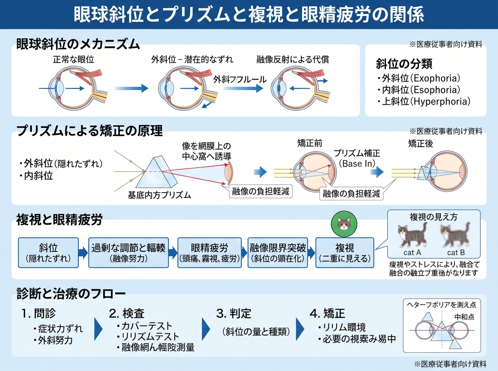 眼球斜位とプリズムと複視と眼精疲労