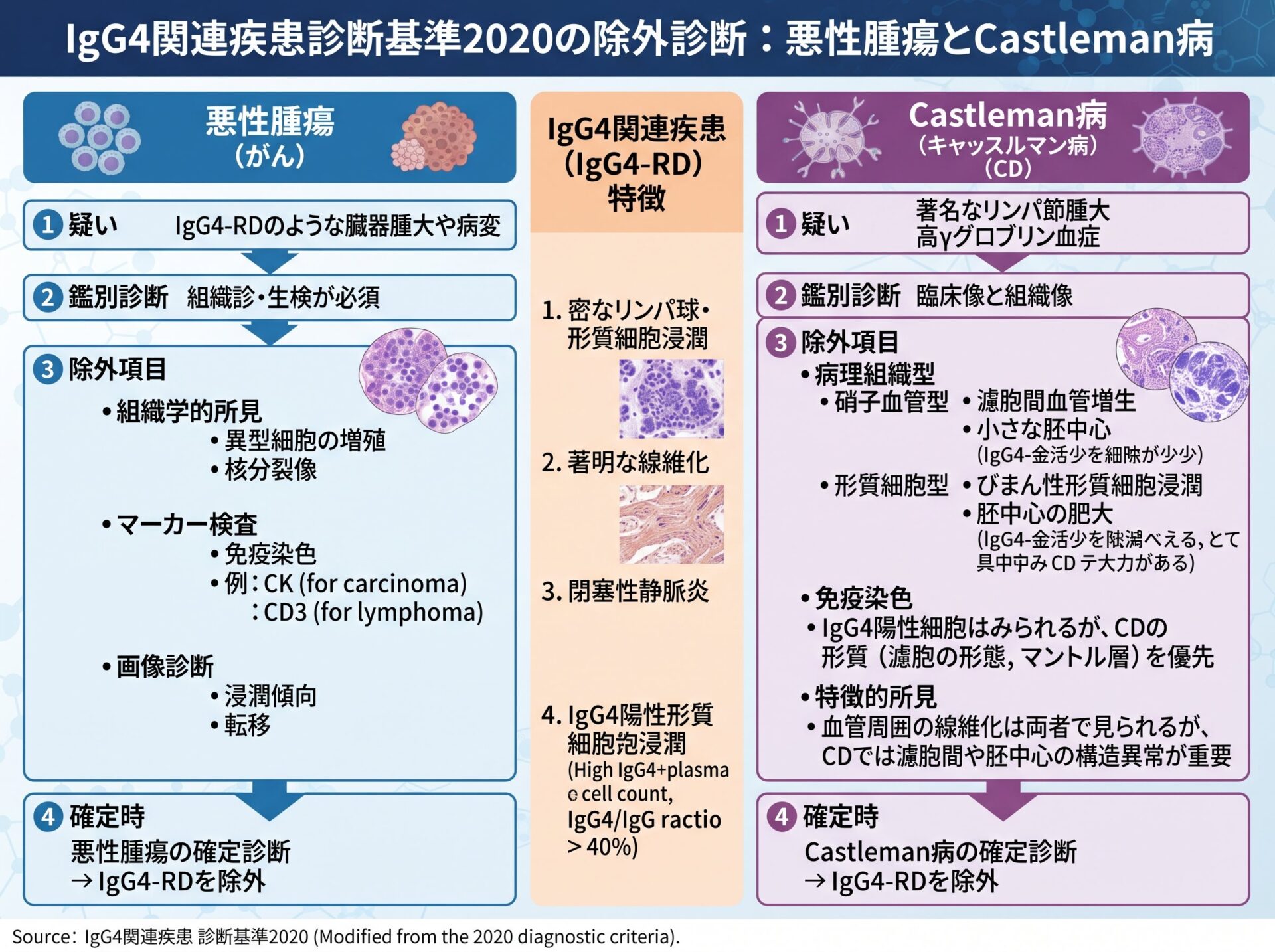igg4関連疾患診断基準2020の除外診断：悪性腫瘍とCastleman病