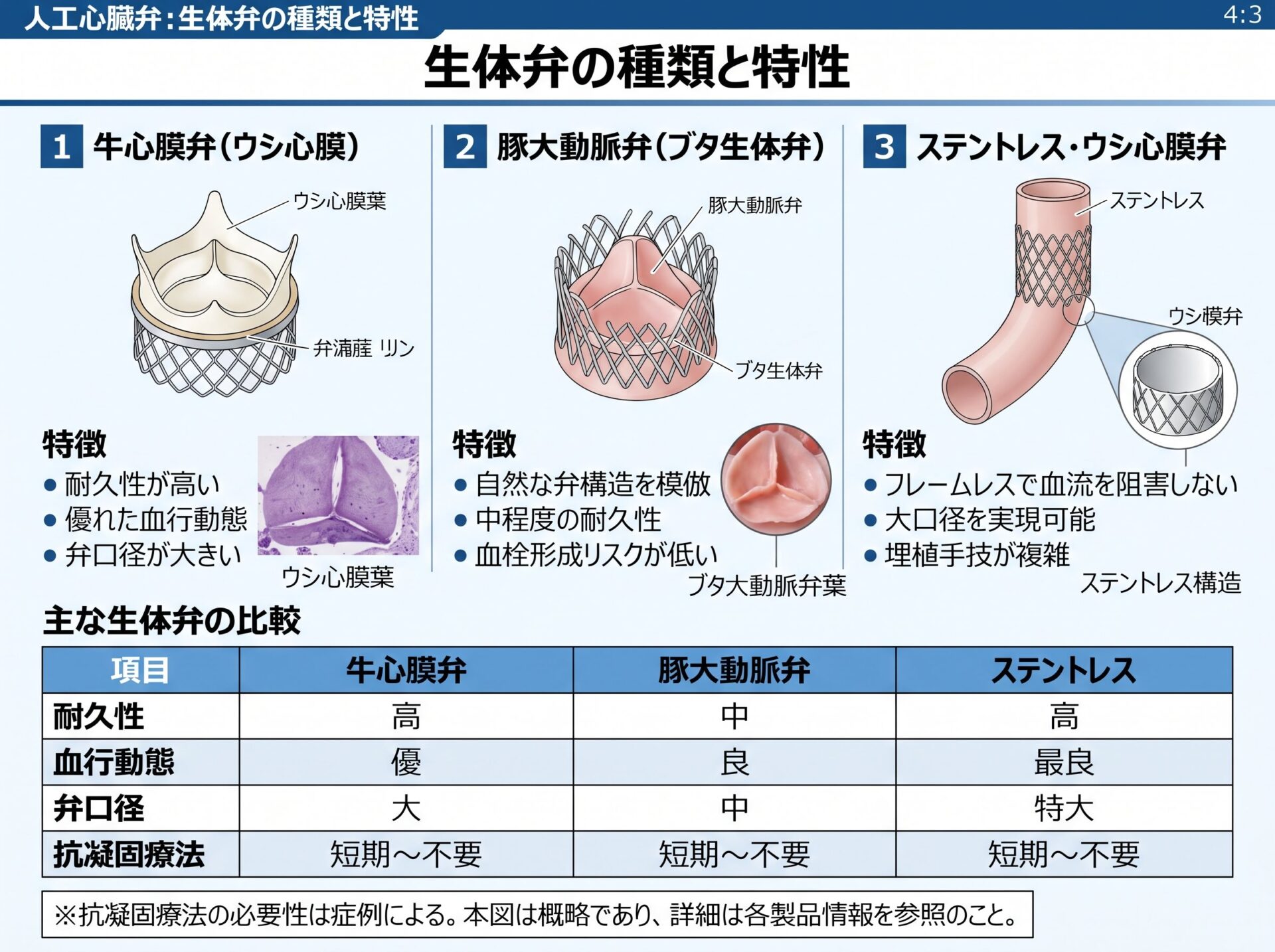 人工心臓弁の生体弁の種類と特性