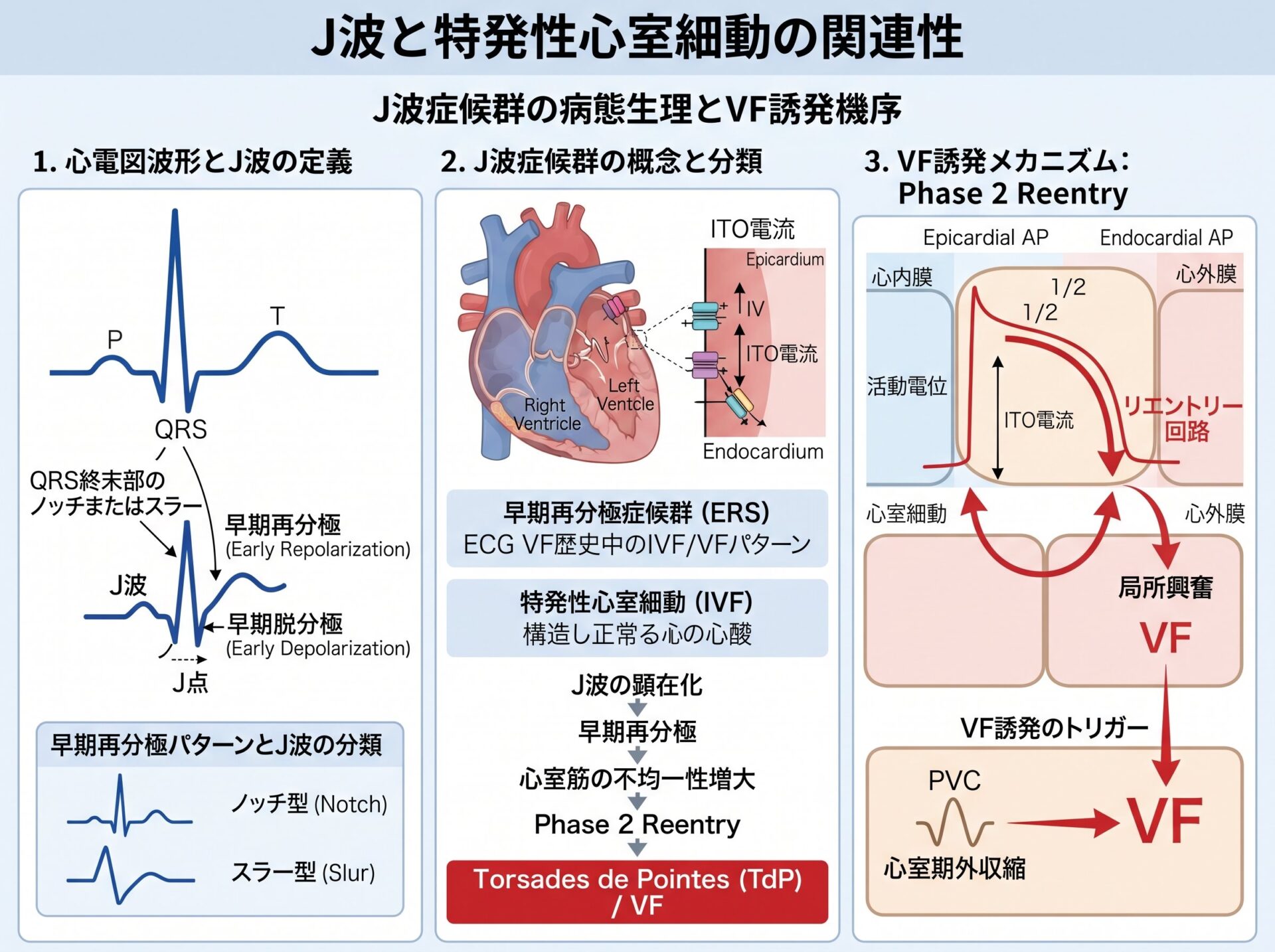 j波と特発性心室細動の関連性