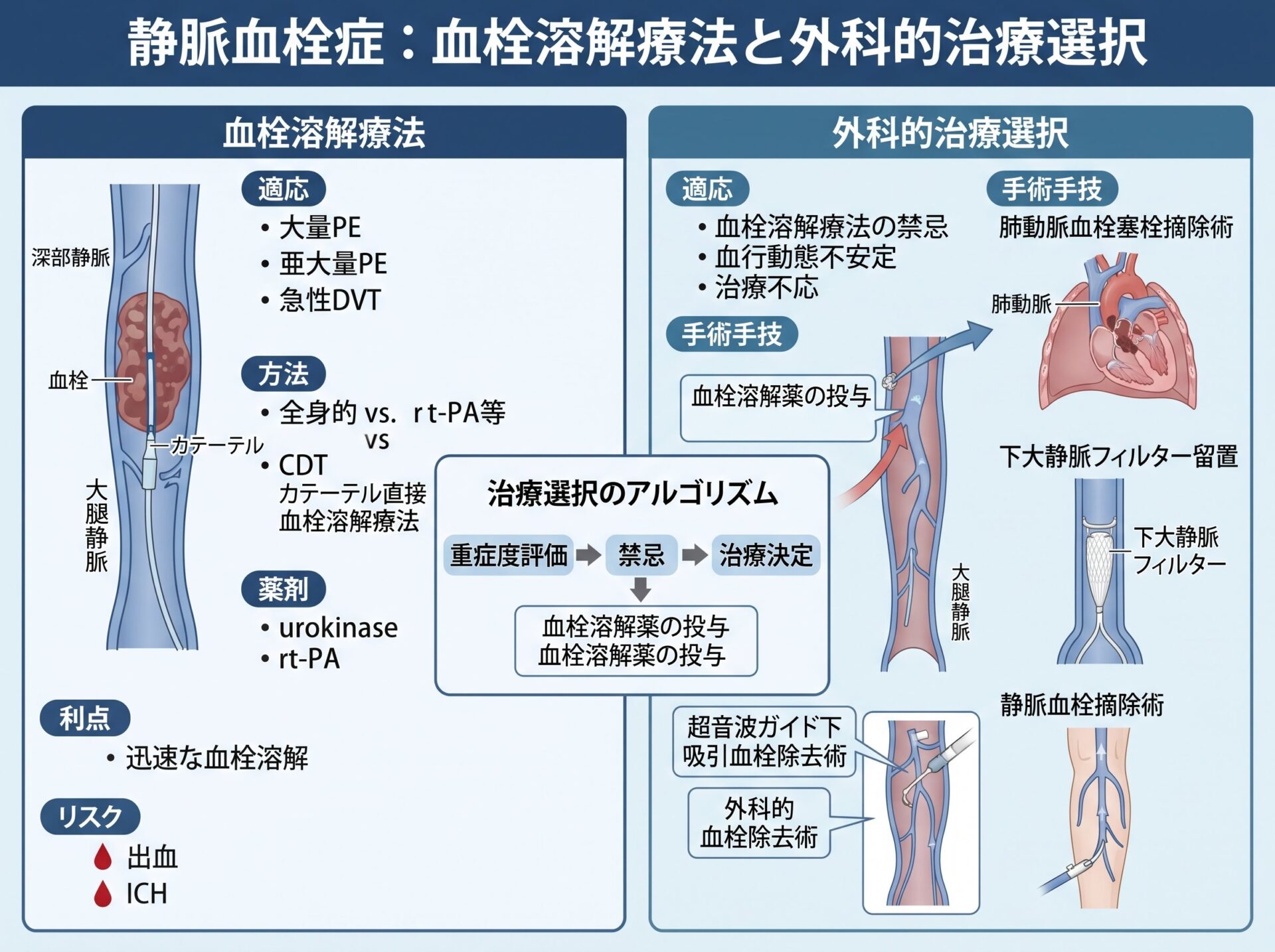 静脈血栓症の血栓溶解療法と外科的治療選択
