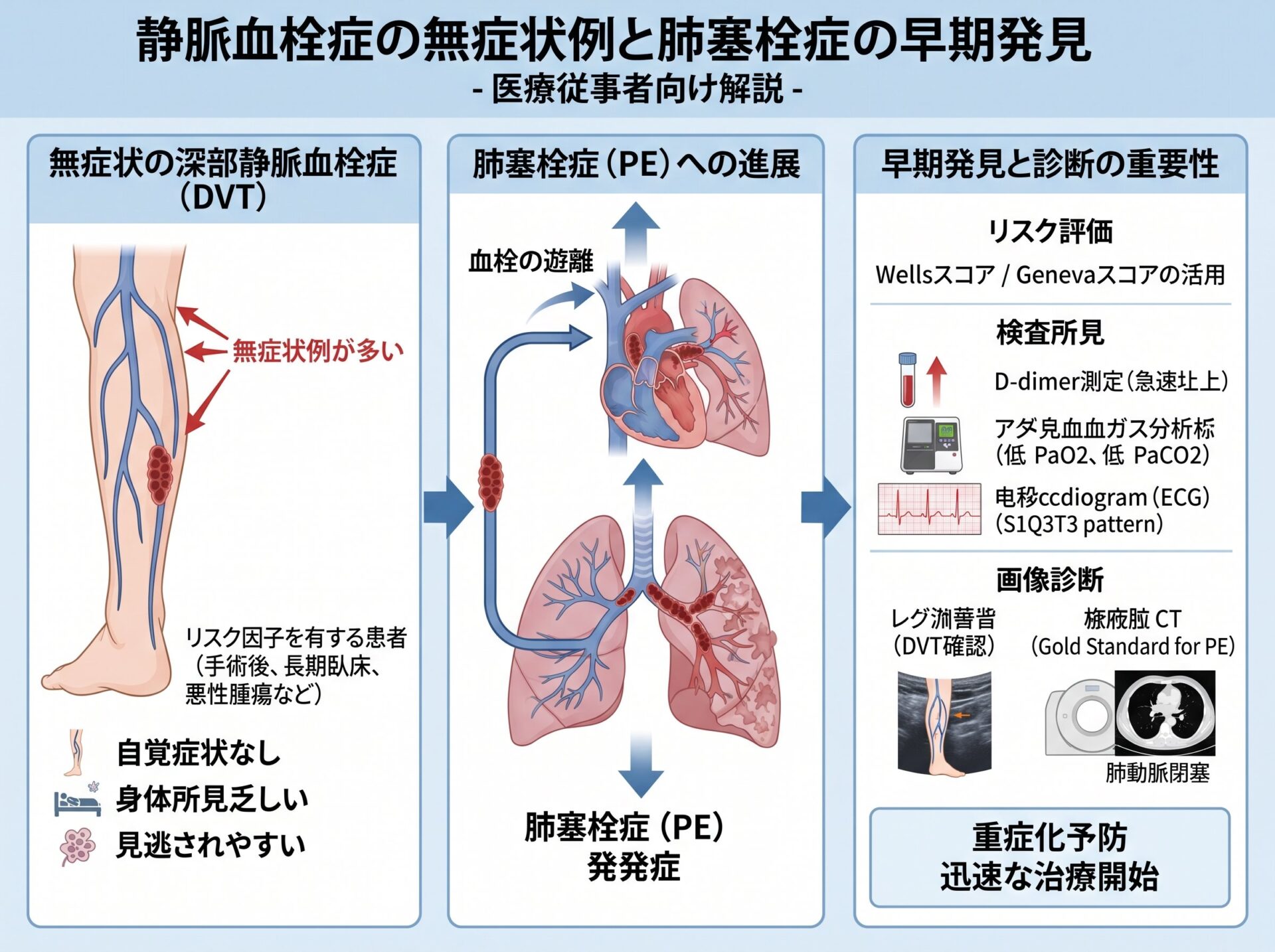 静脈血栓症の無症状例と肺塞栓症の早期発見