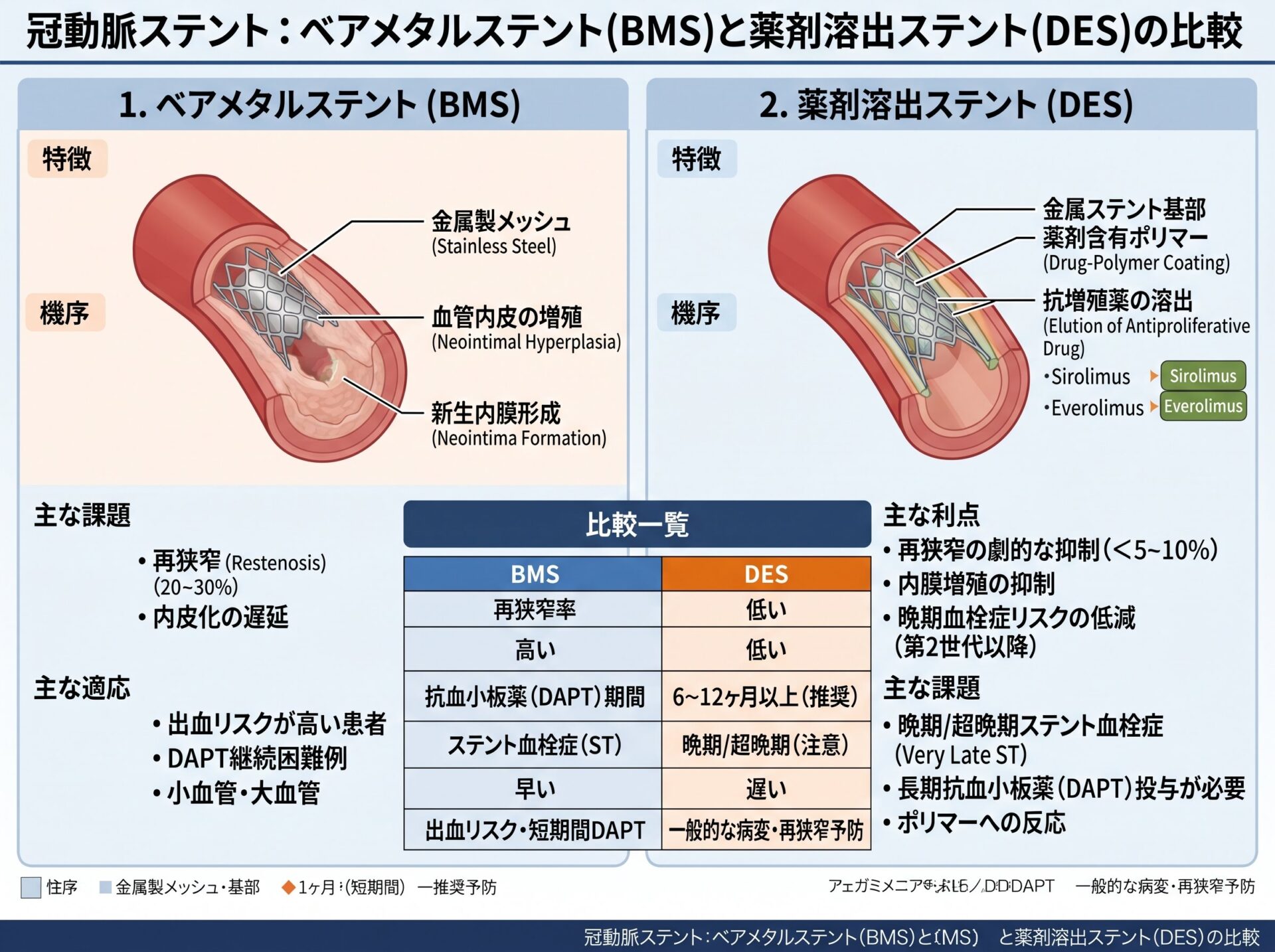冠動脈ステントのベアメタルステントと薬剤溶出ステントの比較