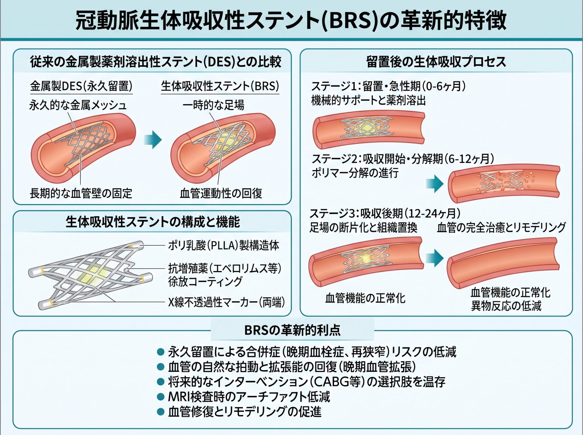 冠動脈ステントの生体吸収性ステントの革新的特徴