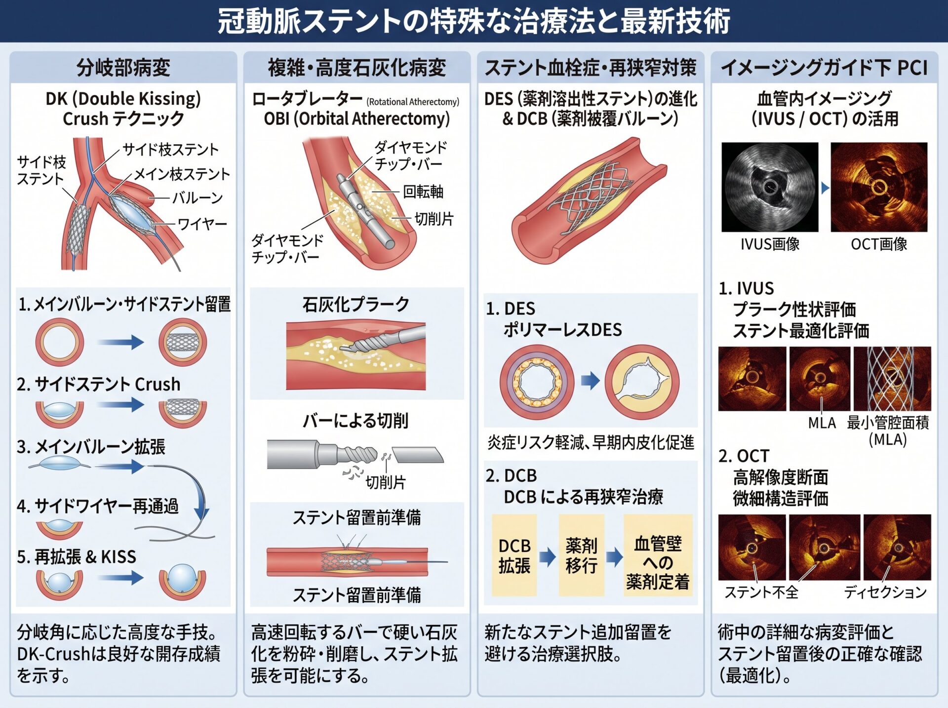 冠動脈ステントの特殊な治療法と最新技術