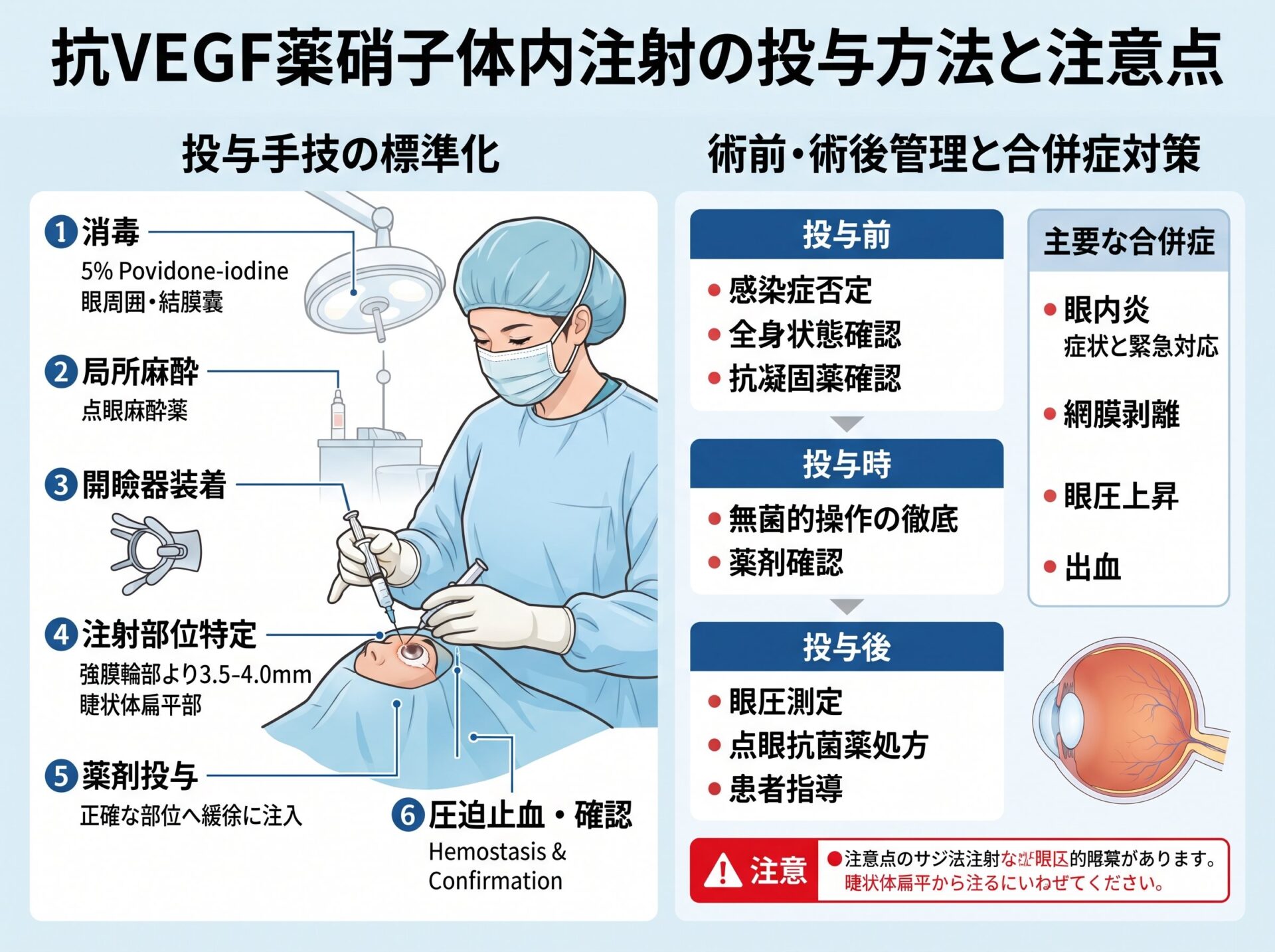 抗VEGF薬の投与方法と注意点