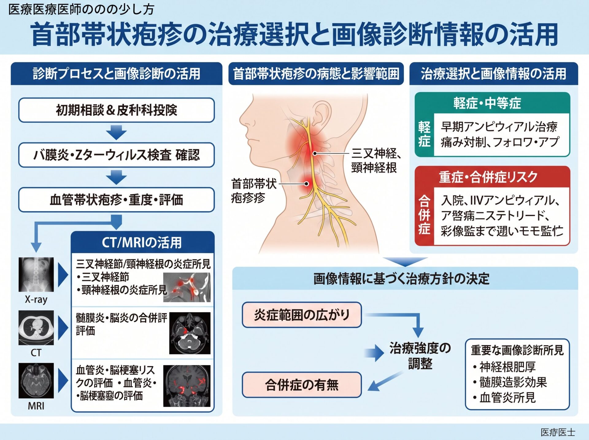首部帯状疱疹の治療選択と画像診断情報の活用