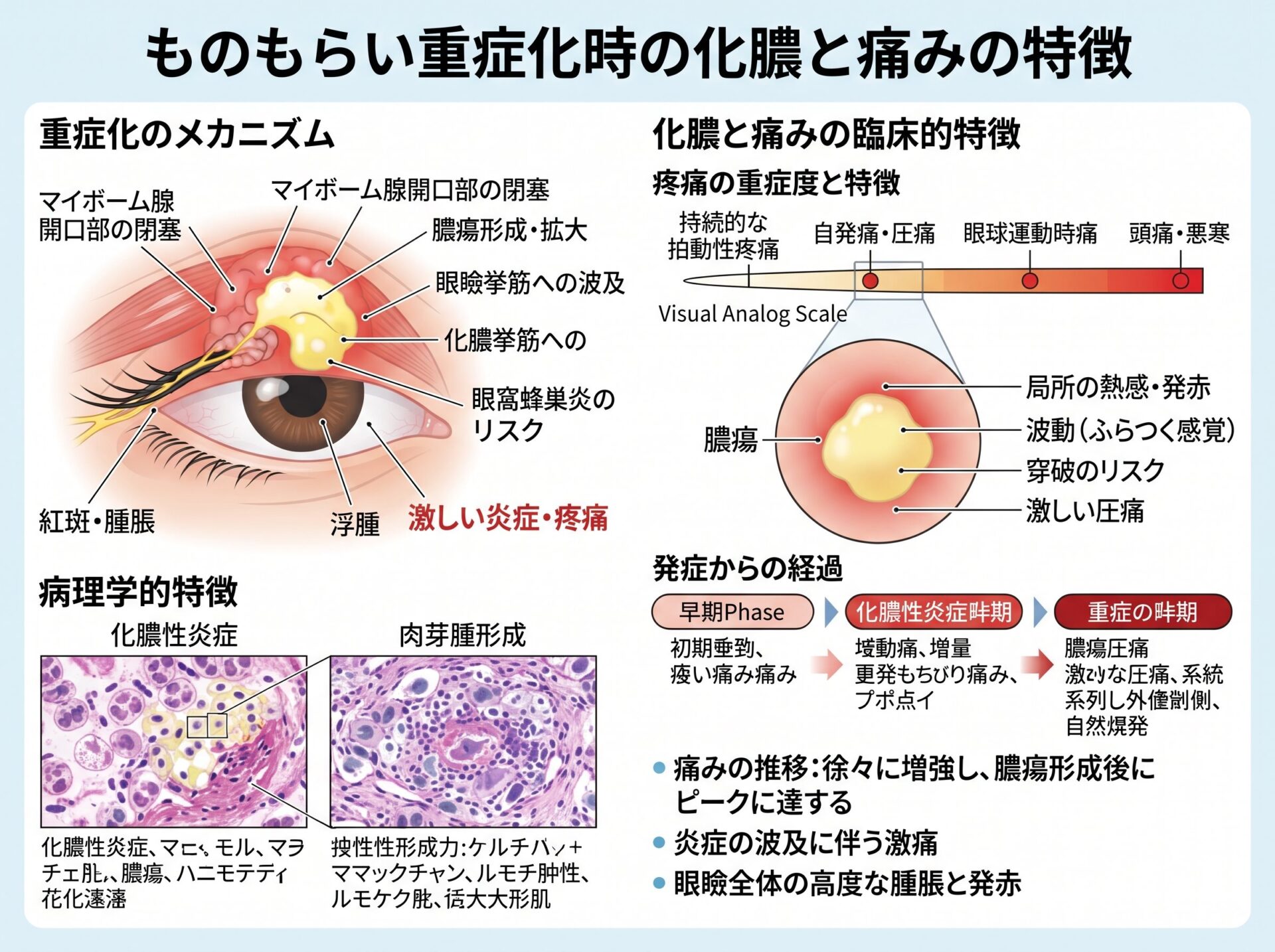 ものもらい重症化時の化膿と痛みの特徴