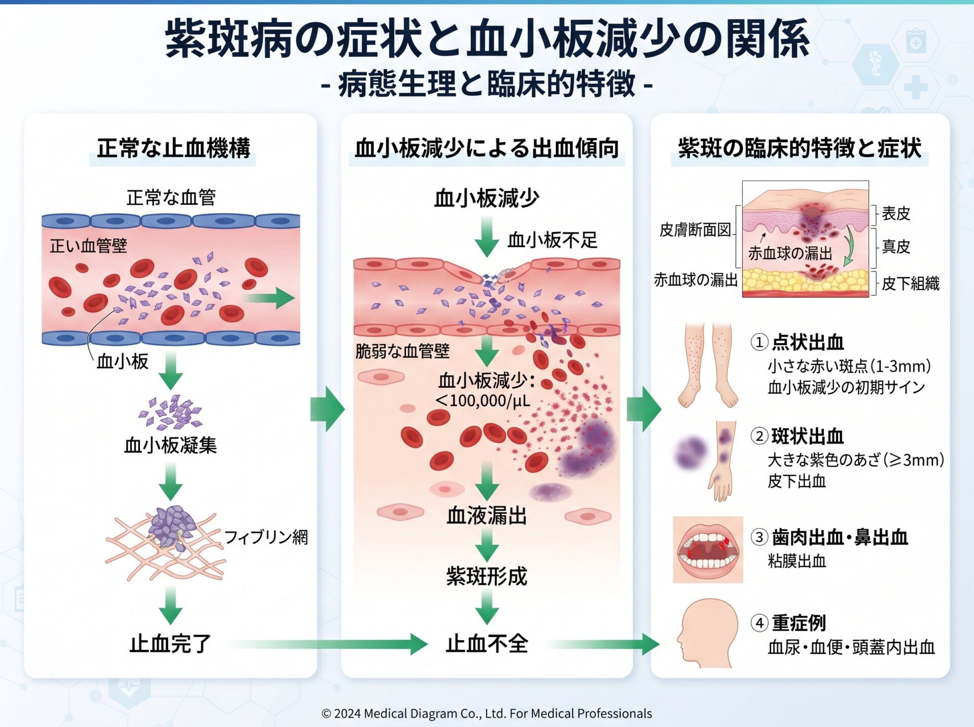 紫斑病の症状と血小板減少の関係