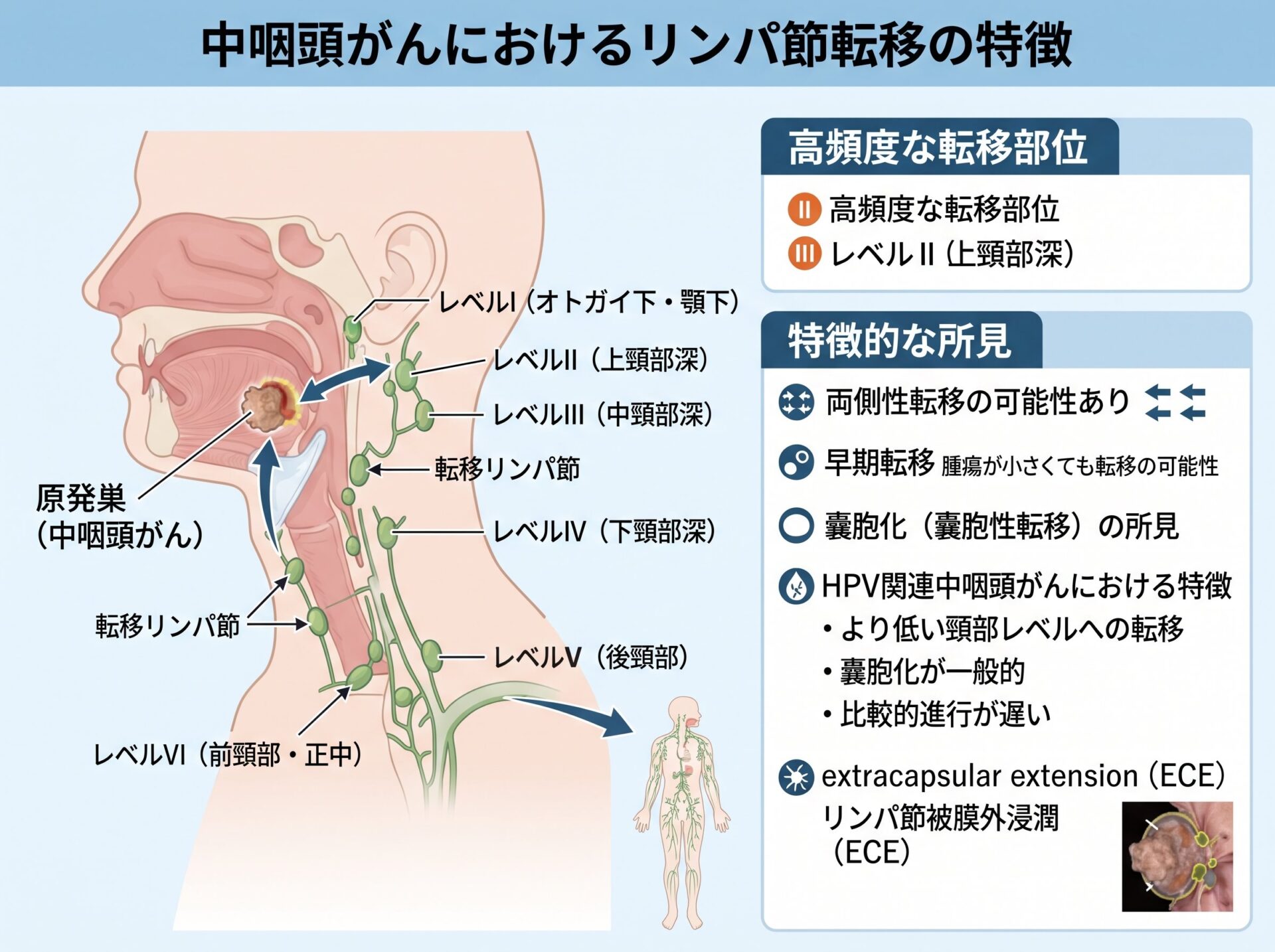中咽頭がんのリンパ節転移の特徴