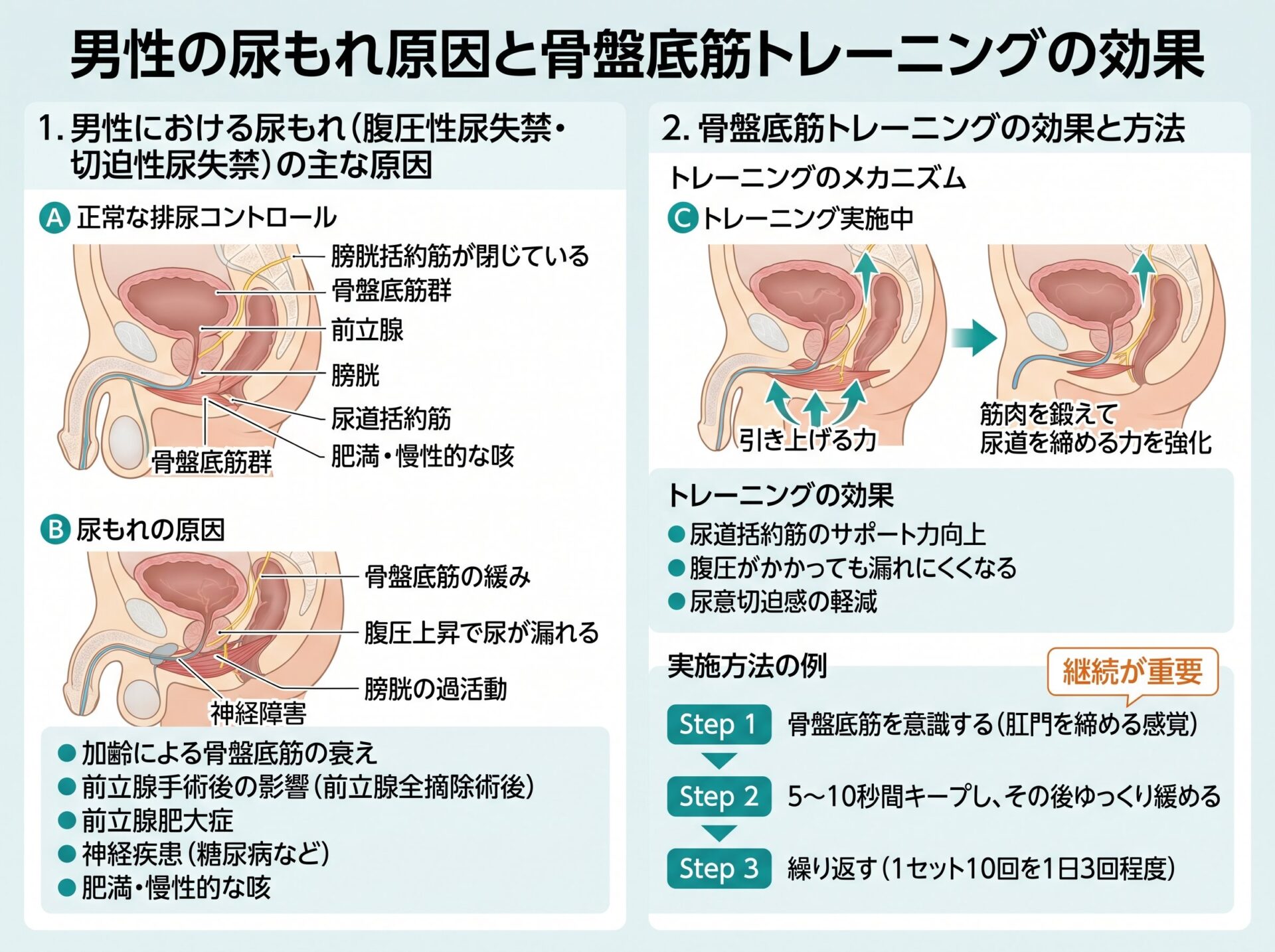 男性の尿もれ原因と骨盤底筋トレーニングの効果