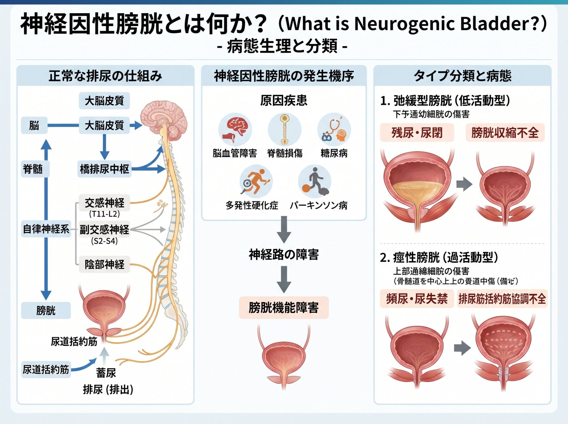 神経因性膀胱とは何か