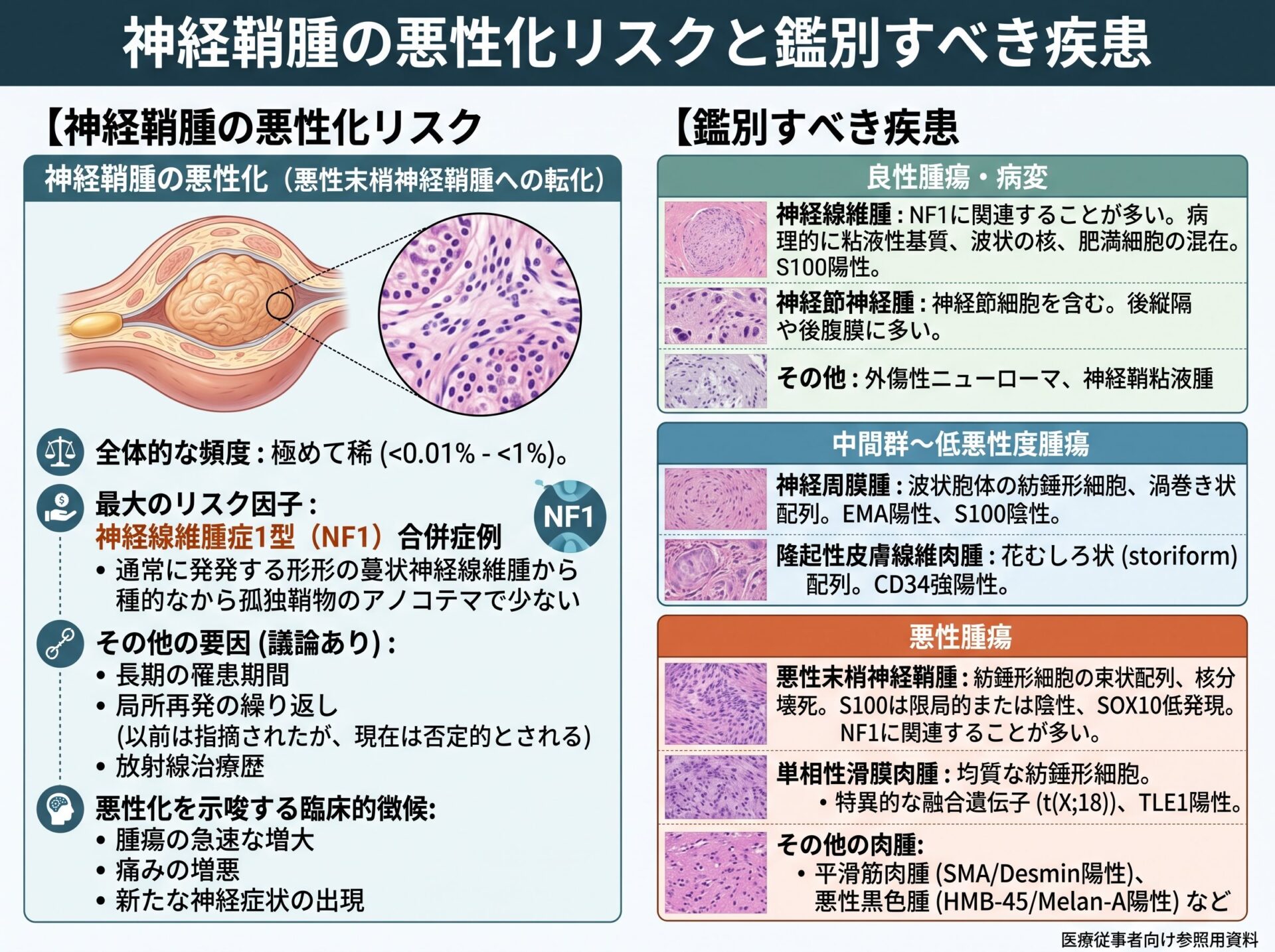 神経鞘腫の悪性化リスクと鑑別すべき疾患