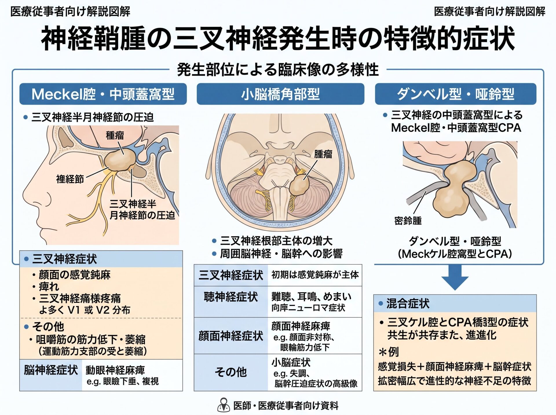 神経鞘腫の三叉神経発生時の特徴的症状