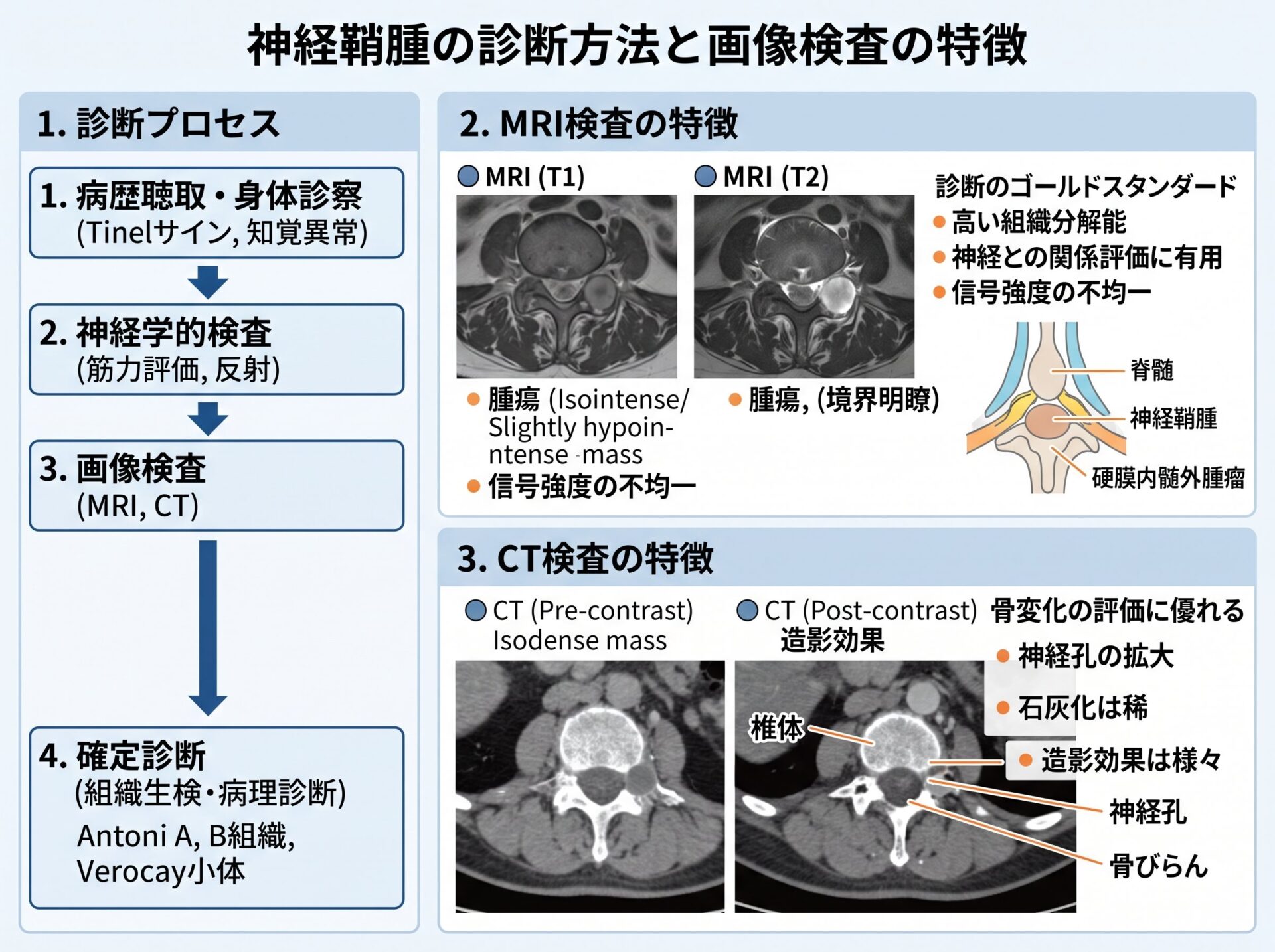 神経鞘腫の診断方法とMRI・CT検査の特徴