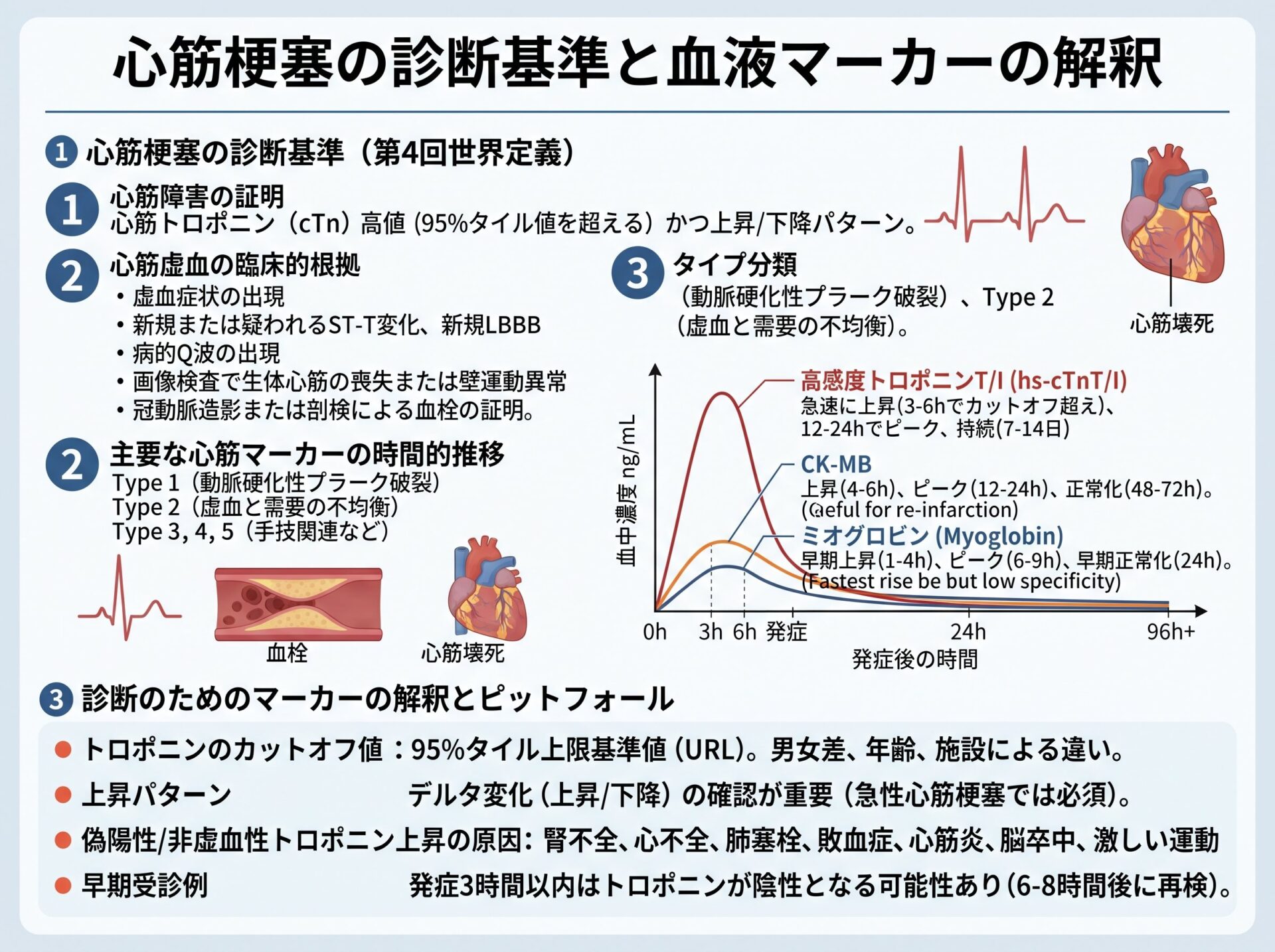 心筋梗塞の診断基準と血液マーカーの解釈