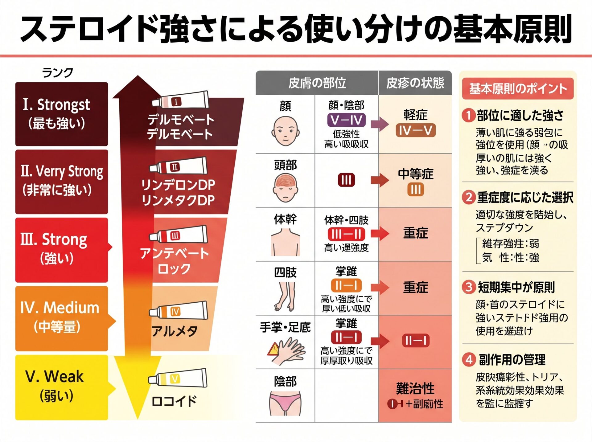 ステロイド強さによる使い分けの基本原則