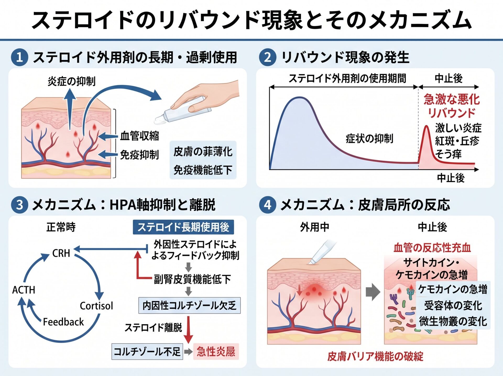 ステロイドのリバウンド現象とそのメカニズム