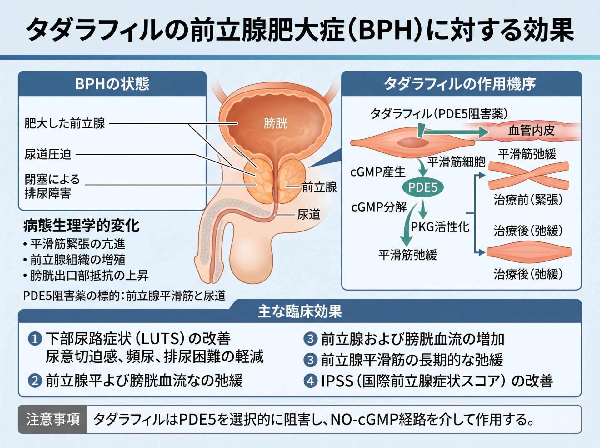 タダラフィルの前立腺肥大症への効果