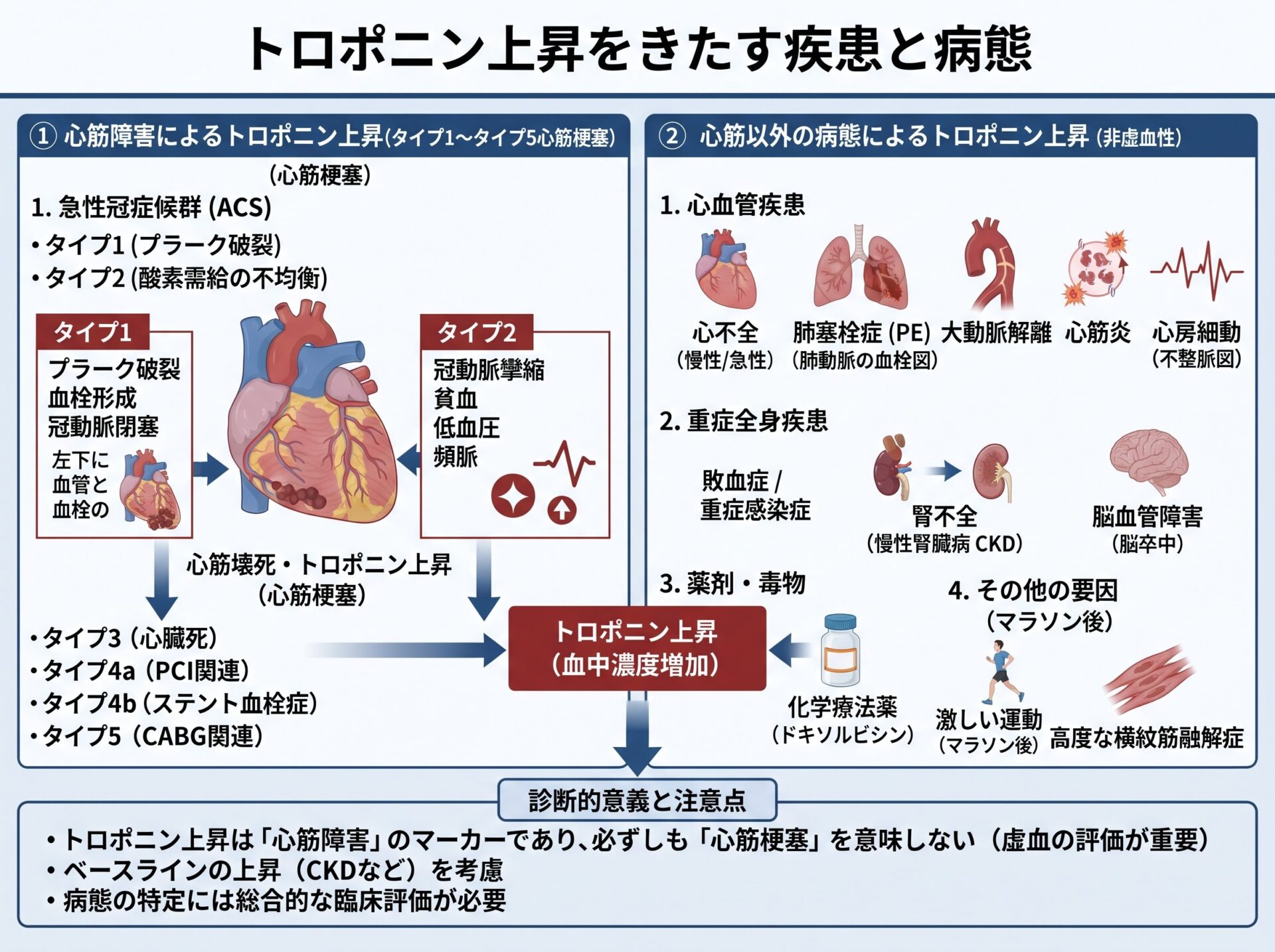 トロポニン上昇をきたす疾患と病態