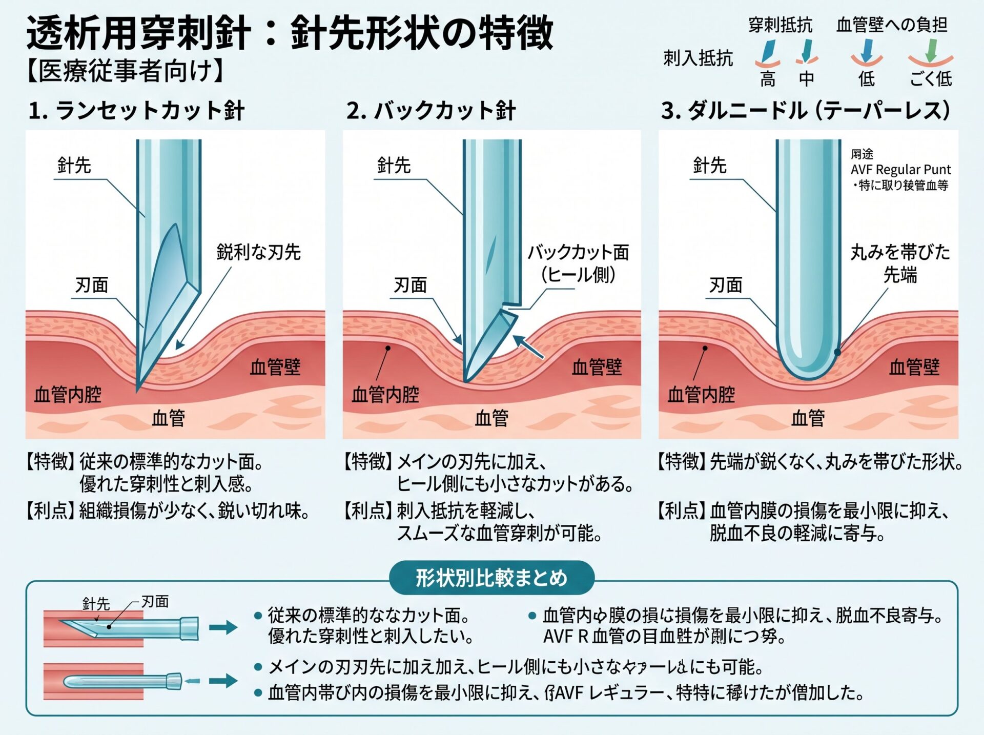 透析用穿刺針 特徴：針先形状（ランセットカット・バックカット・ダルニードル）