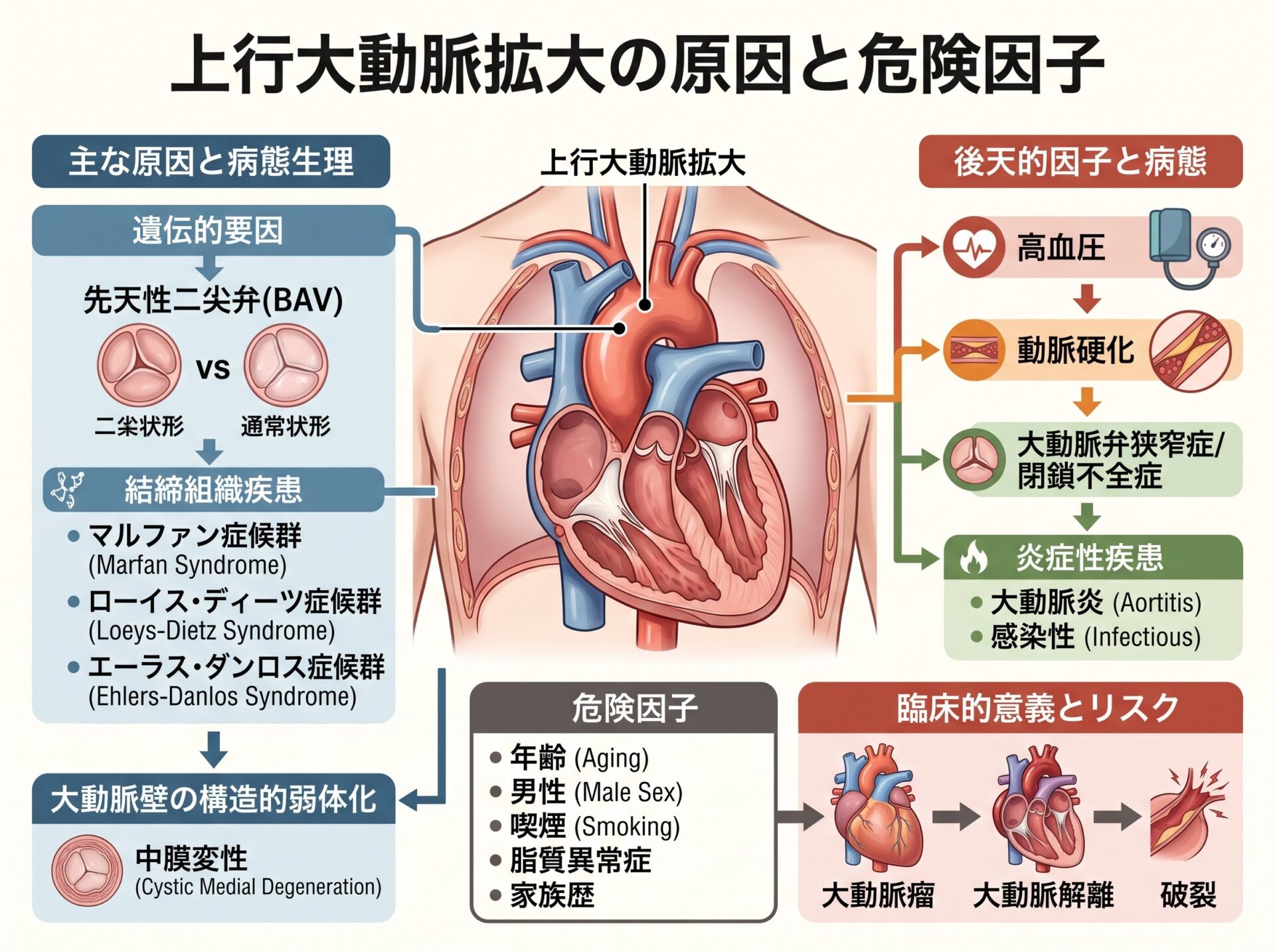 上行大動脈拡大の原因と危険因子