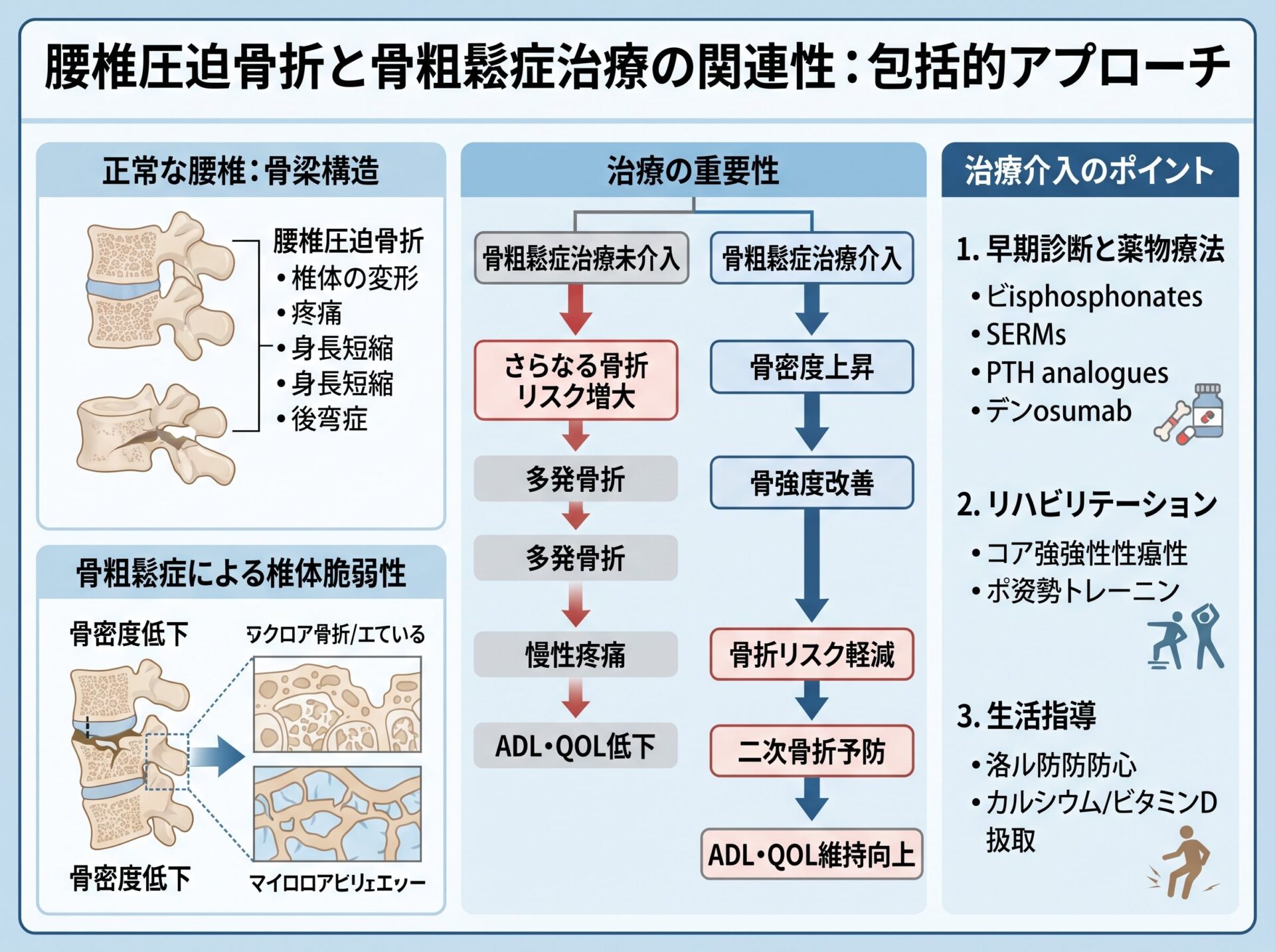 腰椎圧迫骨折と骨粗鬆症治療の関連性